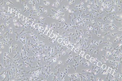 Human Thyroid Carcinoma Cell Line (Undifferentiated) , #C643