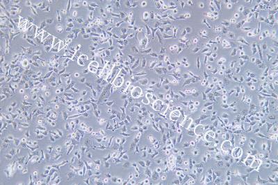 Human Thyroid Carcinoma Cell Line (Undifferentiated) , #CAL-62