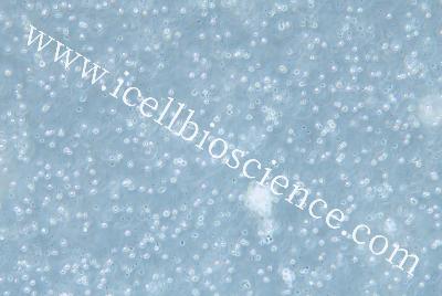 Human B Lymphocytes, #GM12878