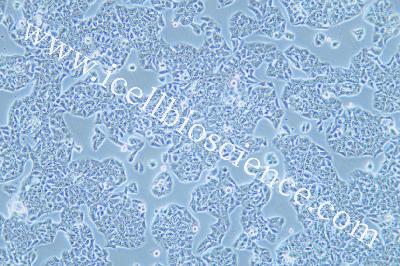 Human Adenocarcinoma Cell Line Of The Lung Cancer, #HCC1833