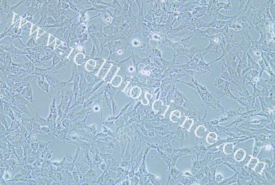 Human Thyroid Carcinoma Cell Line (Undifferentiated) , #KHM-5M
