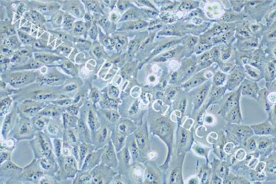 Human Thyroid Carcinoma Cell Line (Undifferentiated) , #KMH-2