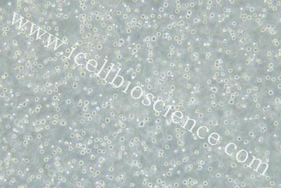 Human Acute Myeloid Leukemia Cell Line, #MOLM-13
