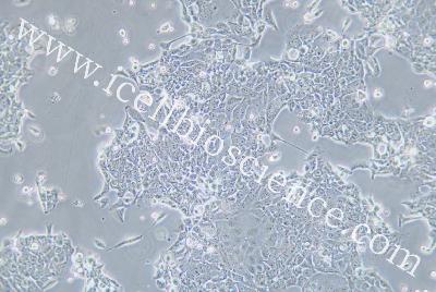 Human Esophageal Cell Line, #OE33