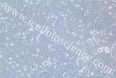 Lung Tatastatic Cell Line In Human Colon Adenocarcinoma, #T84