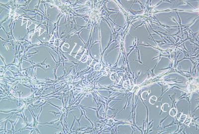 Astroglioblastoma Of The Human Brain + LUC, #U87MG+LUC