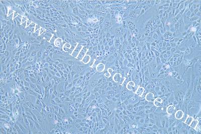 Human Pancreatic Cancer Cell Line, #PANC 08.13