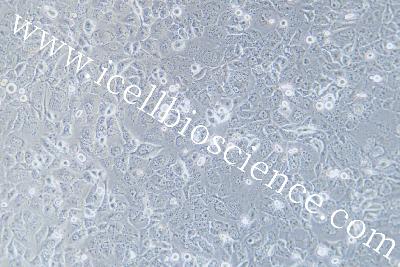 Human Thyroid Carcinoma Cell Line (Undifferentiated) , #TTA1