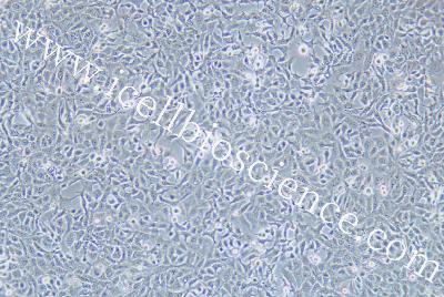 Human Non-Small-Cell Lung Cancer Cell Line, #NCI-H1568