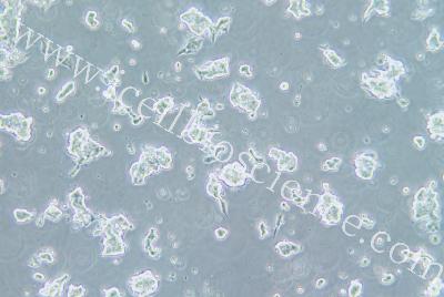 Human Small-Cell Lung Cancer Cell Line, #NCI-H209