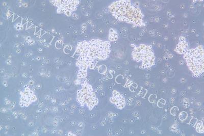 Human Small-Cell Lung Cancer Cell Line, #NCI-H146