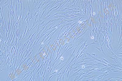 Human Lung Fibroblasts, #HFL1