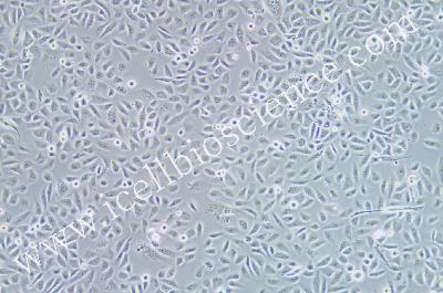 Human Bronchial Epithelial Cell Line, #HBE135-E6E7