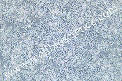 Human Colonic Adenocarcinoma Cell Line, #RKO