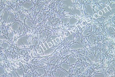 Astroglilastoma Of The Human Brain, #U87MG