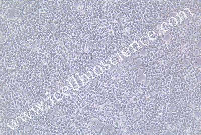 Human Embryonic Kidney (HEK 293) Cell Line, high yield Lentiviral Packaging, #LENTI-X293T