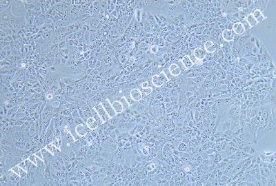 Human Lung Adenocarcinoma Cell Line, #NCI-H441