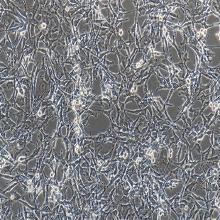 Human Glioblastoma Cell Line, #A172
