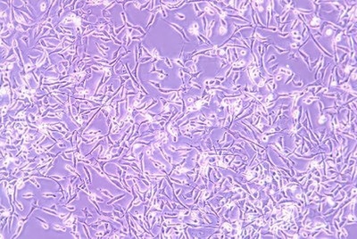 Human Rhabdomyosarcoma Cell Line, #A-204