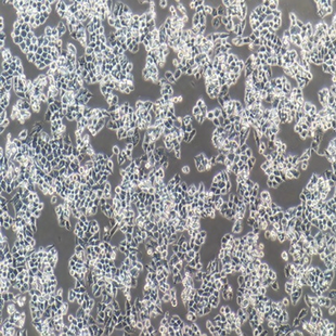 Human Ovarian Cancer Cell Line, #A2780