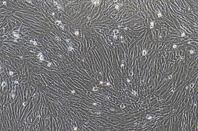 Human Dermal Fibroblasts (Immortalized In Primary Cell Line) , #HSF (SV40)