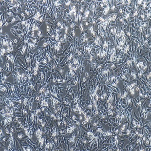Human Malignant Melanoma Cell Line, #A375