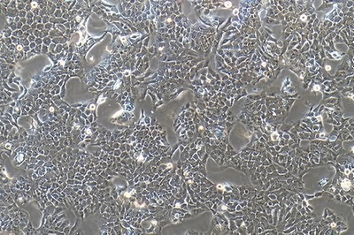 Colon Cancer Cell Line, #CX-1