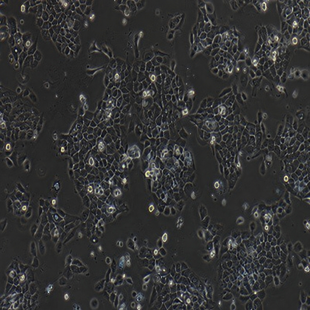 Human Epidermal Cancer Cell Line, #A431 (A-431)