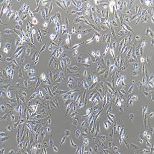 Human Kidney Cancer Cell Line, #A498
