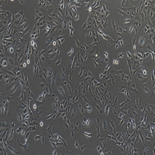 Human Lung Cancer Cell Line, #A549