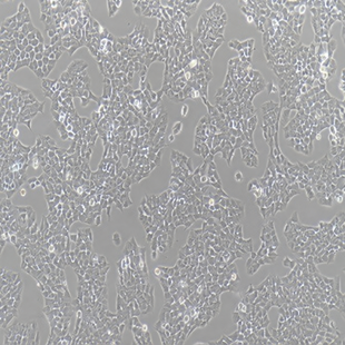 Human Rhabdomyoma Tumor Cell Line, #A673