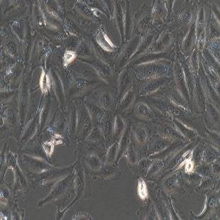 Human Melanoma Cell Line, #A875