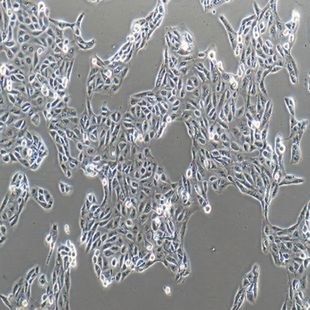 Human Renal Cell Adenocarcinoma Cell Line, #ACHN