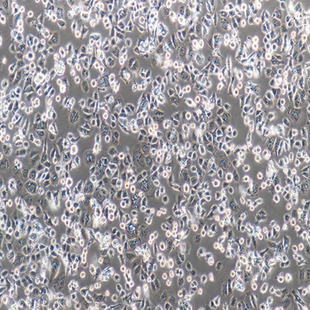Human Gastric Adenocarcinoma Cell Line, #AGS