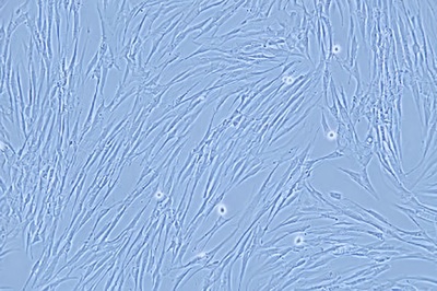 Human Lung Fibroblasts, #HFL1