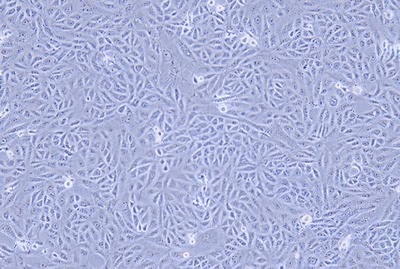 Human Endometrial Adenocarcinoma Cell Line, #AN3CA