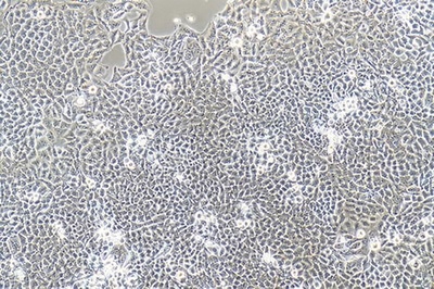 Human Cervical Carcinoma Cell, #AV3
