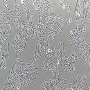 Human Retinal Pigment Epithelial Cell Line, #ARPE-19
