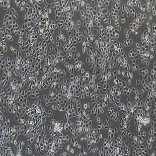 Human Metastasized Pancreatic Adenocarcinoma Cell Line, #ASPC-1