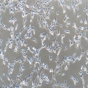 Human Thyroid Cancer Cell Line, #BCPAP
