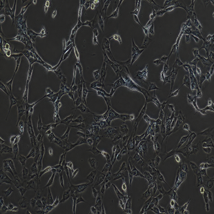 Human Bronchial Epithelial Cell Line, #BEAS-2B