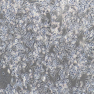 Human Liver Cancer Cell Line, #BEL-7402