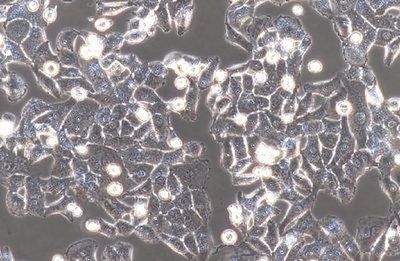 Human Cervical Carcinoma Cell, #BT-B
