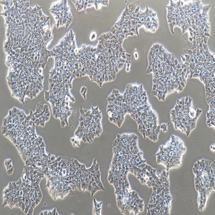 Human Breast Ductal Cancer Cell Line, #BT-474