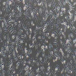 Human Breast Ductal Cancer Cell Line, #BT-549
