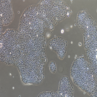Human In Situ Pancreatic Adenocarcinoma Cell Line, #BXPC-3
