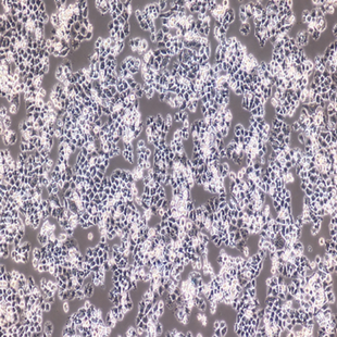 Human Cervical Carcinoma Cell, #C-33A