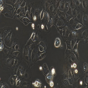 Human Colonic Adenocarcinoma Cell Line, #CACO-2