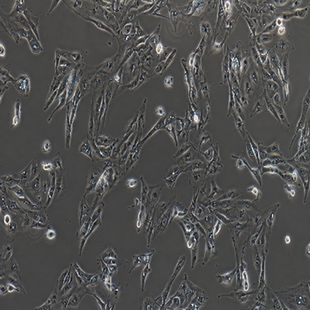 Skin Metastatic Cell Line Of Human Renal Clear Cell Carcinoma, #CAKI-1