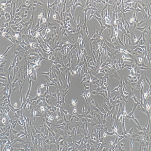 Human Lung Cancer Cell Line, #CALU-1